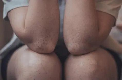 Does Hemp Help Enhance Joint Health? Let’s find out! - CBD Store India