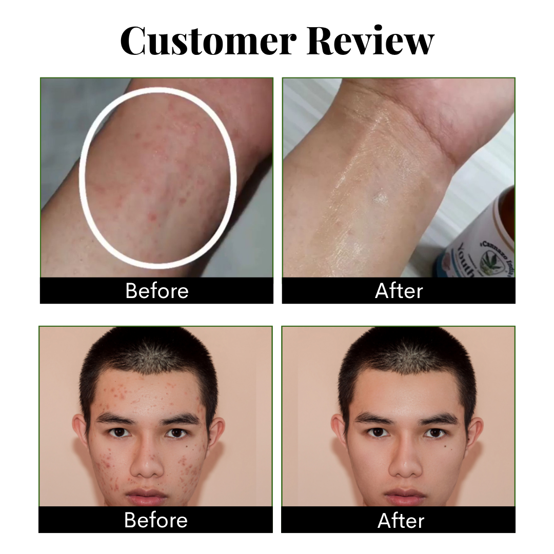 Cannazo Daily Skin Repair Cream | Hydration, Repair & Glow Formula.