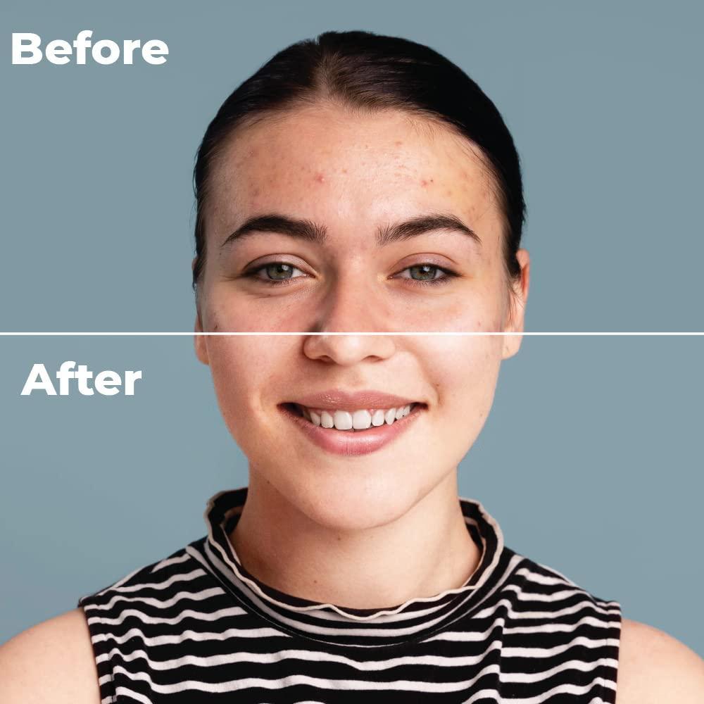 IMROZ FACE SERUM WITH HEMP SEED OIL, KAKADU PLUM, VITAMIN C.