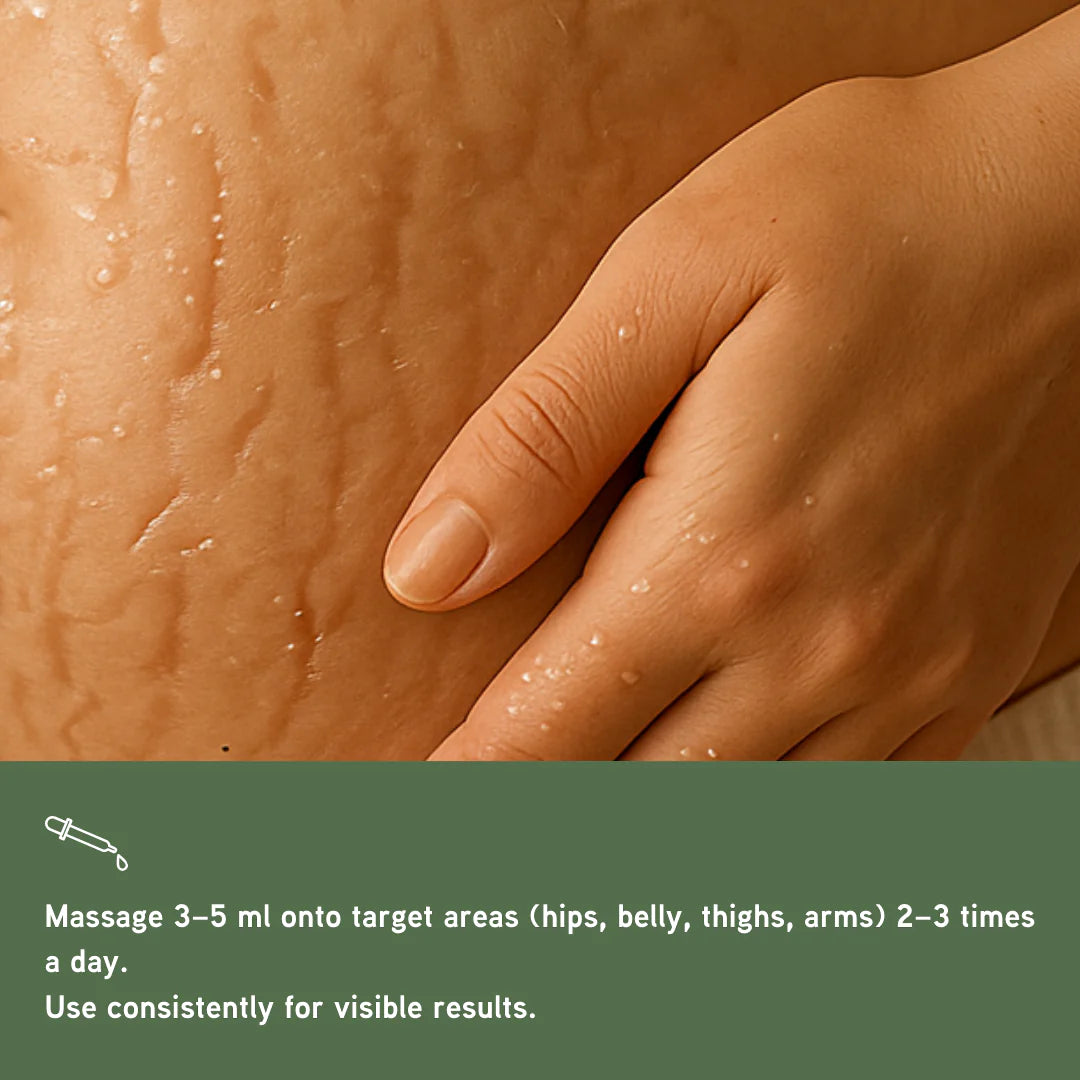 Nuvedic Stretch Mark Oil | Natural Skin Repair & Elasticity Booster.