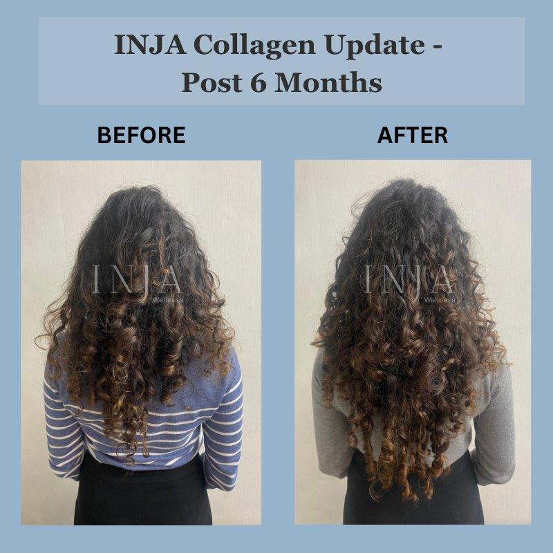 INJA Beauty Collagen for Skin, Hair & Nails, with Vit C, Glutathione,Biotin & more - Lychee FlavourBeauty CollagenINJA Beauty Collagen - Lychee Flavour | Finest Marine Collagen